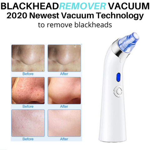 Blackhead Remover Vacuum Facial Pore Cleanser